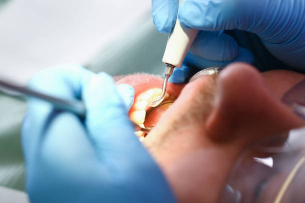 Best Cracked Tooth Emergency Dentist  in Ringgold, LA