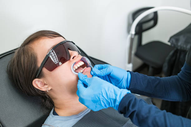 Emergency Dental Filling Replacement in LA