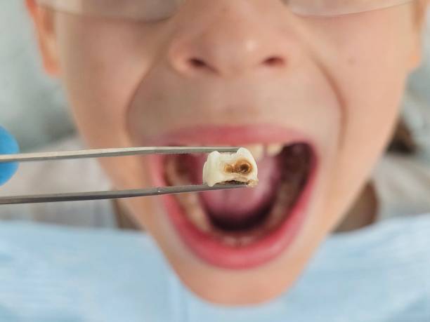 Best Emergency Dentist for Kids  in Ringgold, LA